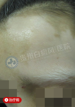 ��ͷ����