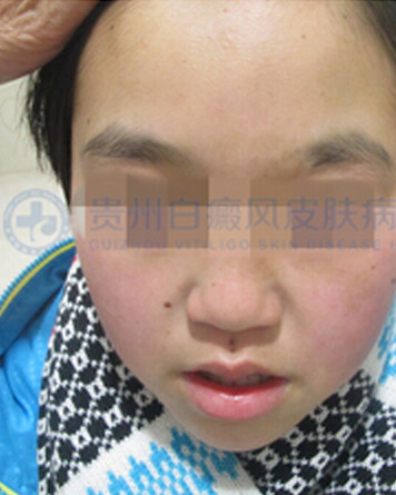 ��ͯ���簸��