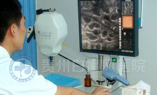 ������άƤ��CT