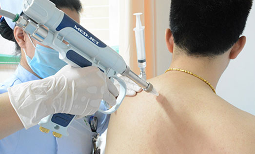 ����ע���Ʒ�