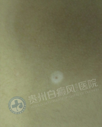 ��ͯ���簸��