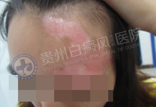 ���翵������֮��