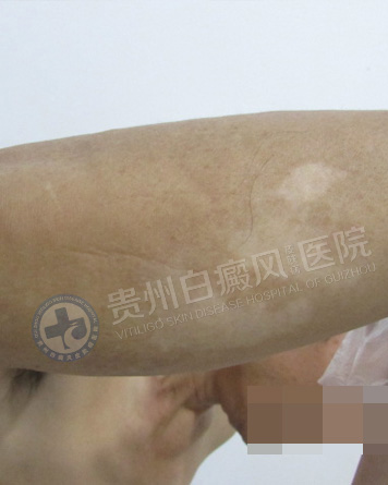 ���԰��簸��