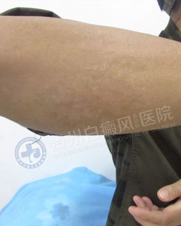 ���԰��簸��