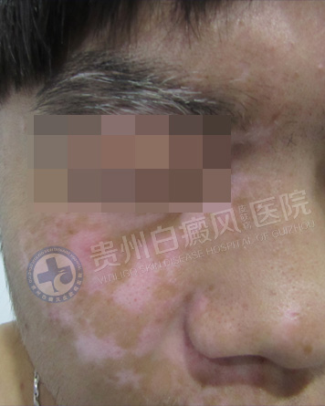 ���԰��簸��