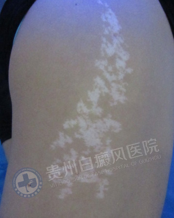 ��������簸��